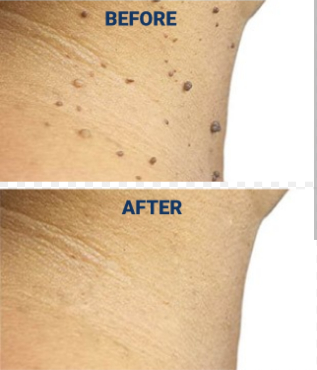 Skin Treatment Result 3
