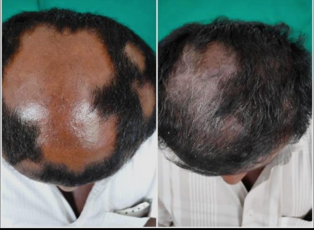 Skin Treatment Result 5