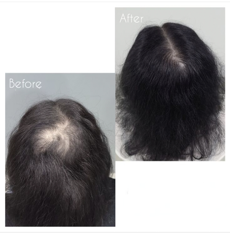 Skin Treatment Result 6