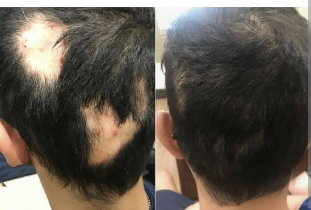 Hair Treatment Result 5