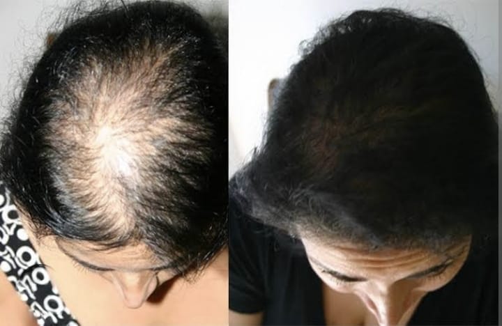 Skin Treatment Result 8