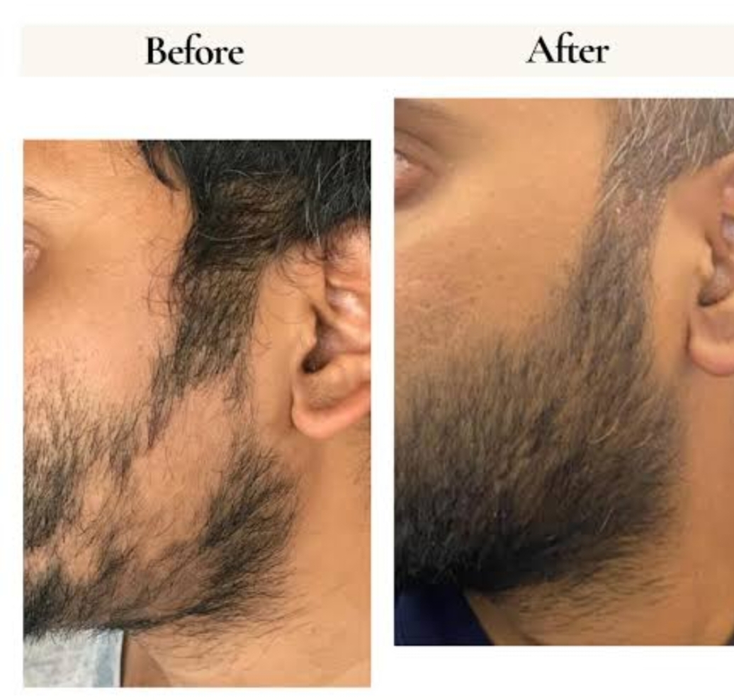 Skin Treatment Result 9